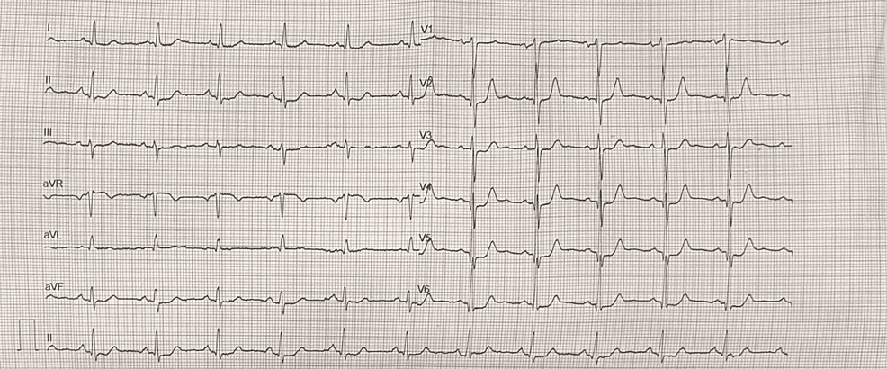 12-lead ECG at initial admission