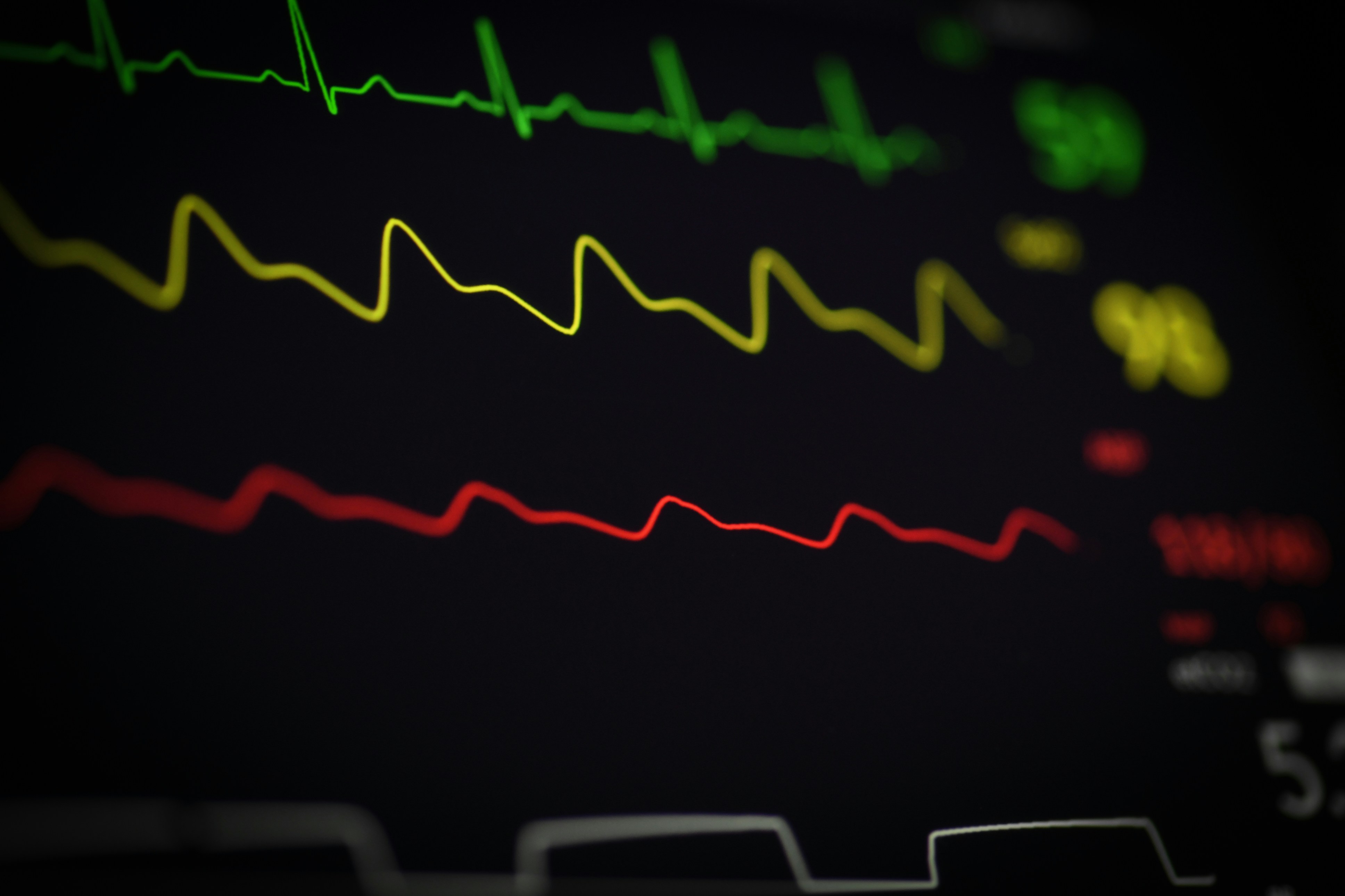 AFib ablation sham
